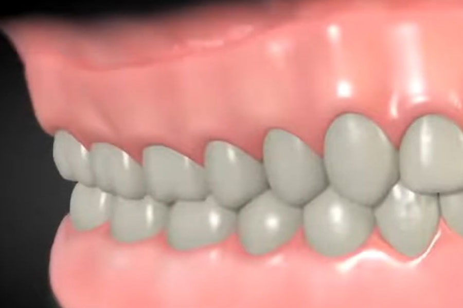 Zobna protetika cenik