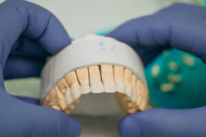 Zobna protetika cenik Lux